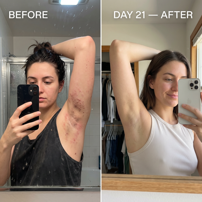 DermGlide Soluzione Lisciante
