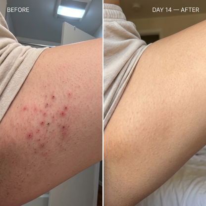 DermGlide Soluzione Lisciante
